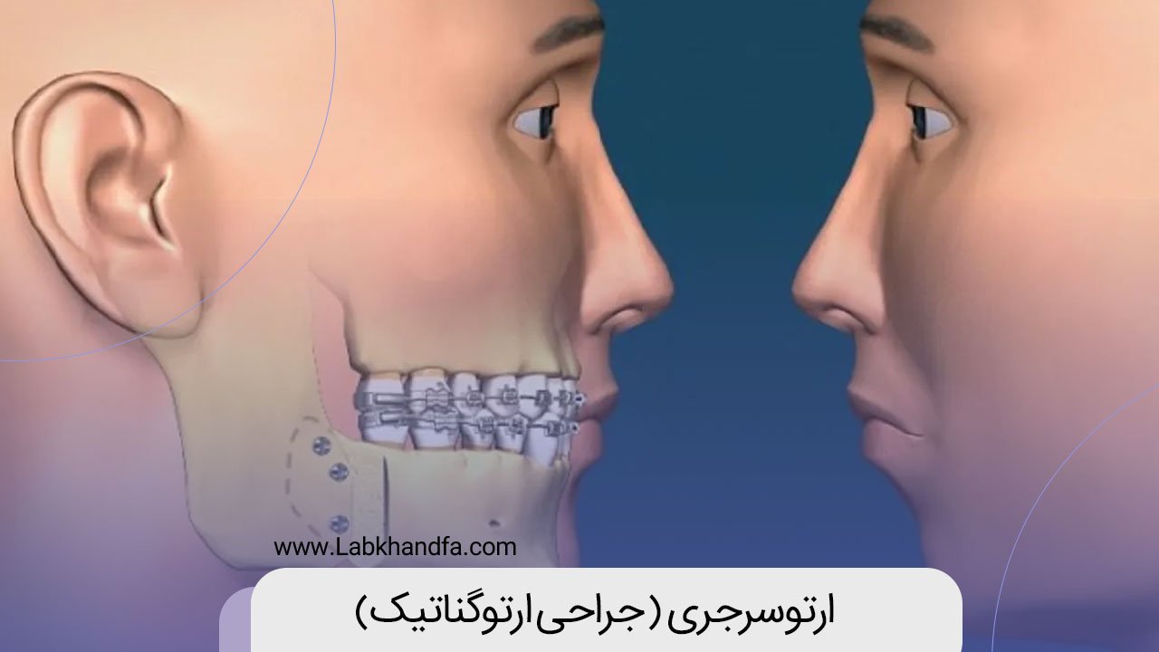 ارتوسرجری یا جراحی ارتوگناتیک