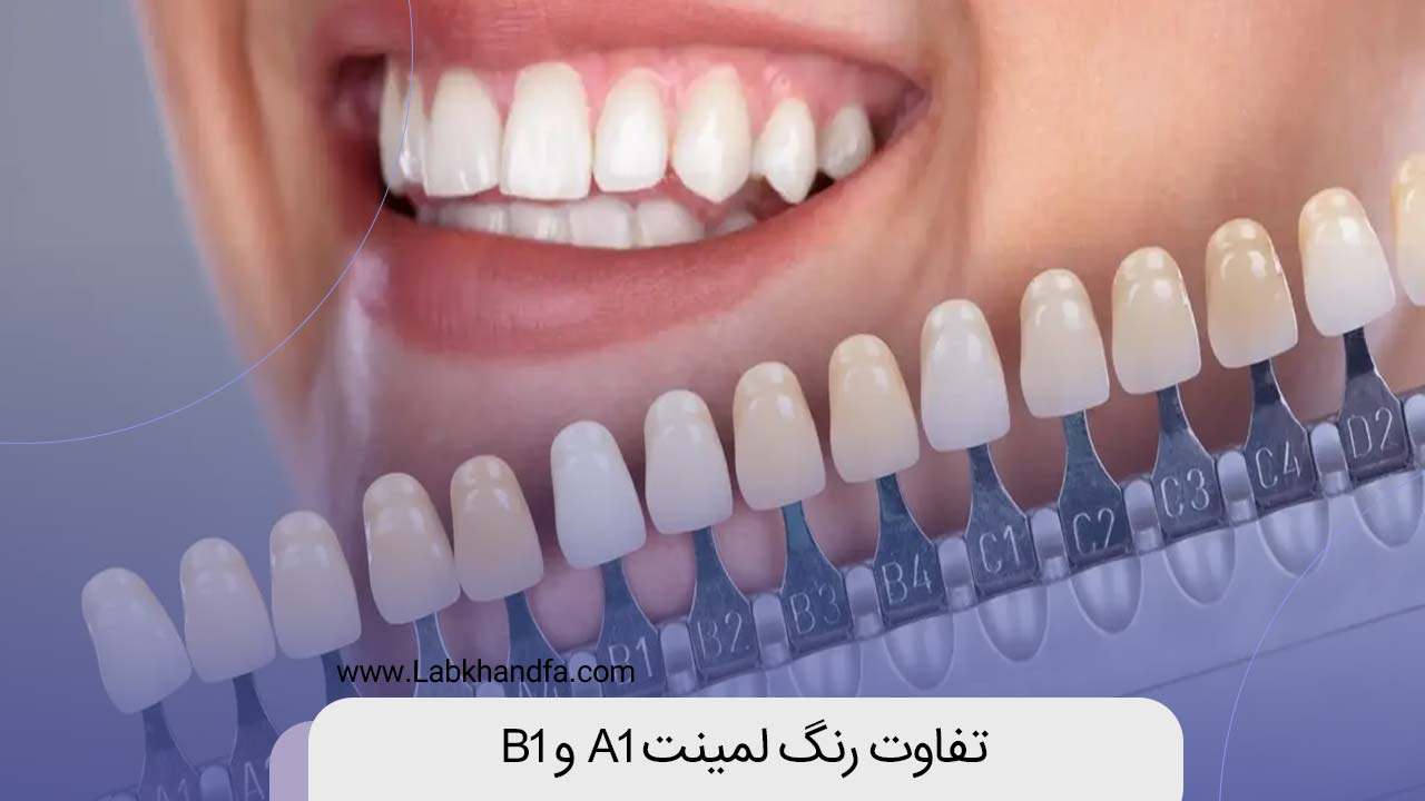 تقاوت رنگ لمینت a1 و b1
