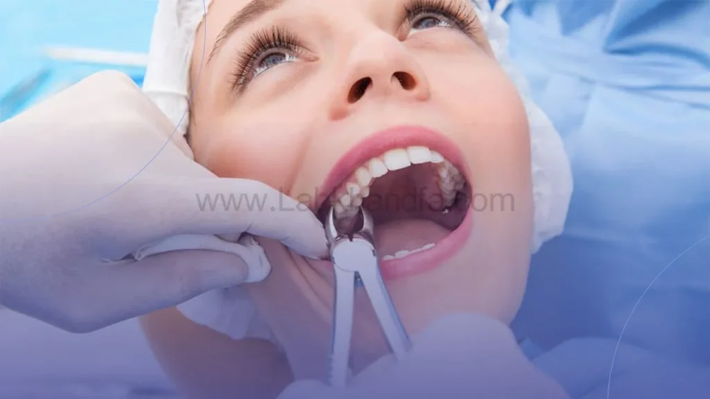 عکسی از کشیدن دندان عقل