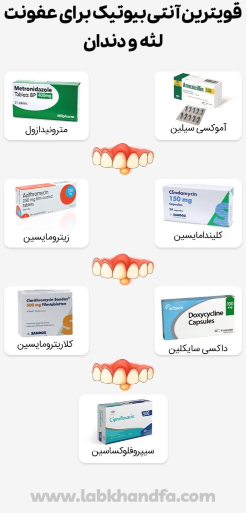 قویترین آنتی بیوتیک برای عفونت لثه و دندان