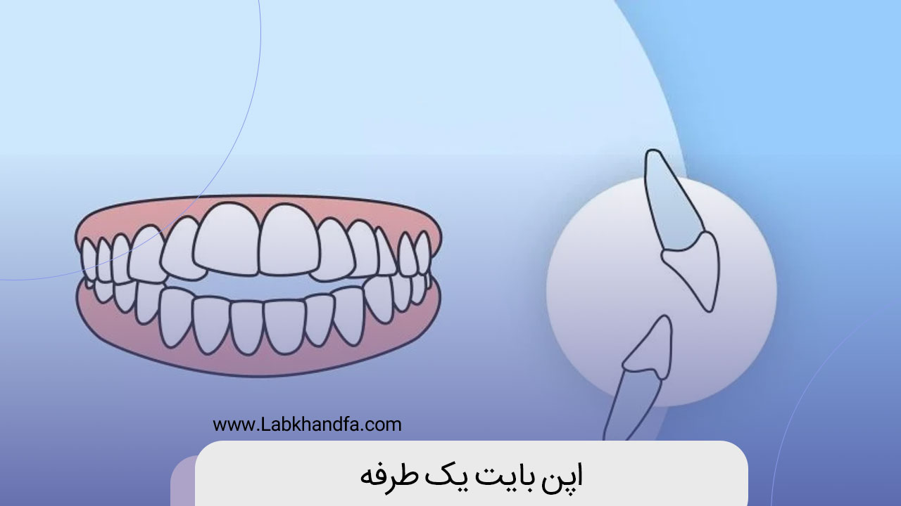 اپن بایت یک طرفه
