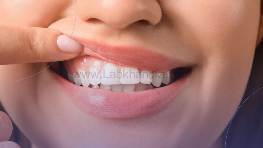 درمان بافت های صدمه دیده لثه دندان