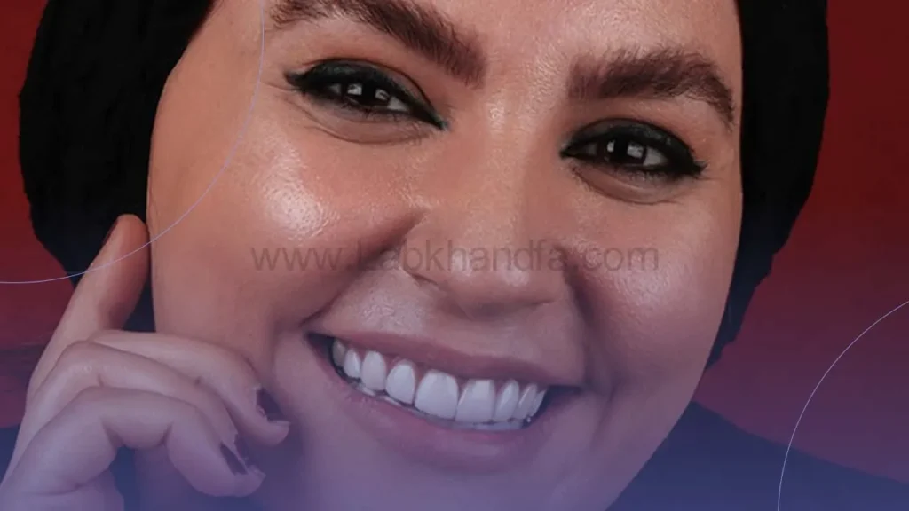 نمونه کار لمینت کلینیک دندانپزشکی عرشیان