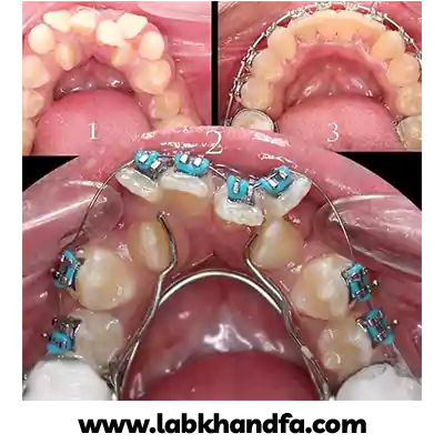 نمونه درمان ارتودنسی دندان دکتر فرناز اسدی