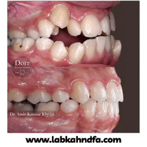 نمونه کار ارتودنسی دکتر کامیار خضری