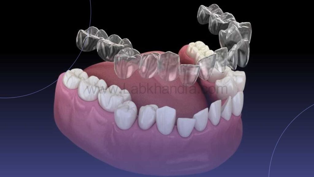 اصلاح دندان کج با ارتودنسی نامرئی