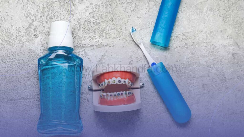 رعایت بهداشت دهان و دندان در طول ارتودنسی