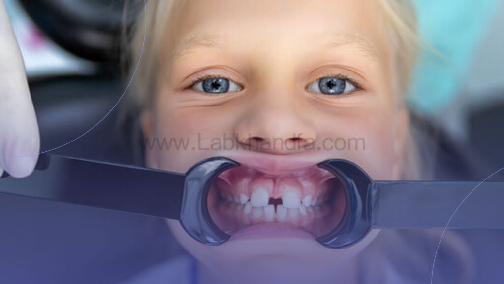 فاصله بین دندان های جلویی کودکان