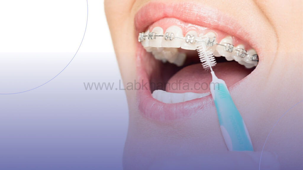 مسواک ارتودنسی