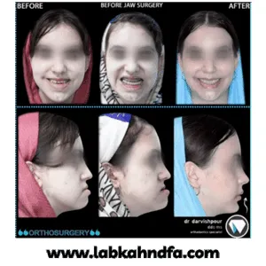 نمونه کار ارتودنسی دکتر هادی درویش پور