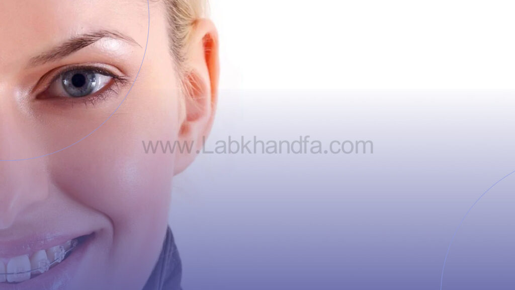 ارتودنسی سرامیکی دندان بزرگسالان