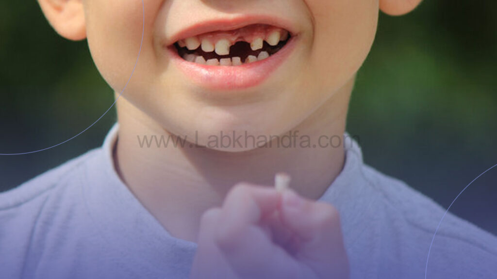 افتادن دندان شیری