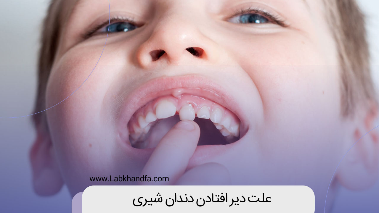 علت دیر افتادن دندان شیری