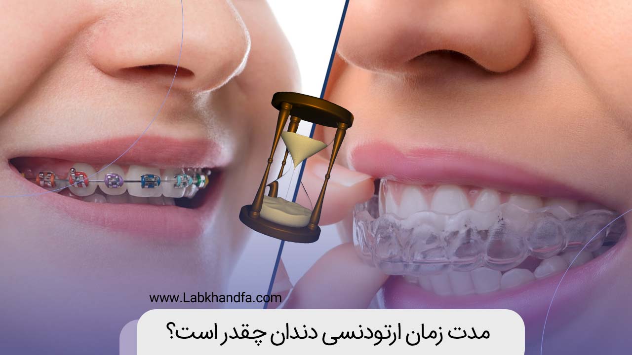 مدت زمان ارتودنسی دندان چقدر است؟