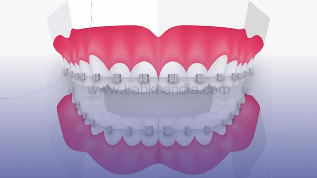ارتودنسی دندان
