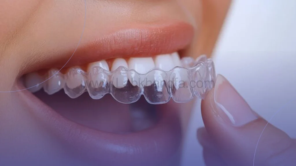 ارتودنسی شفاف