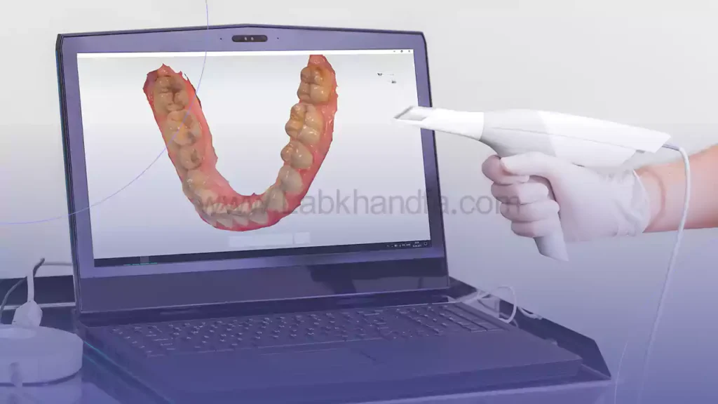 قالب گیری دندان ها در ارتودنسی