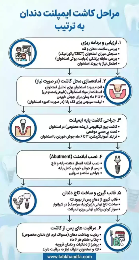 مراحل کاشت ایمپلنت دندان به ترتیب