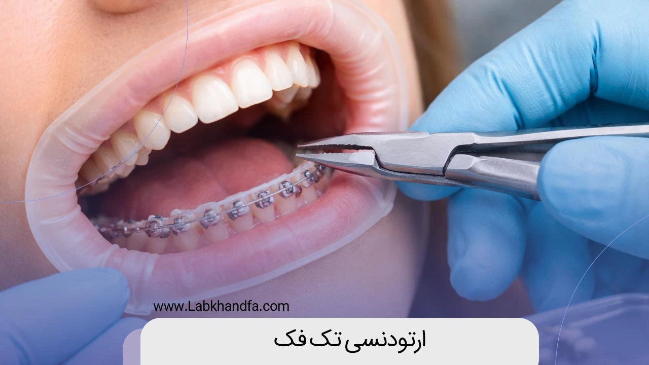 ارتودنسی تک فک