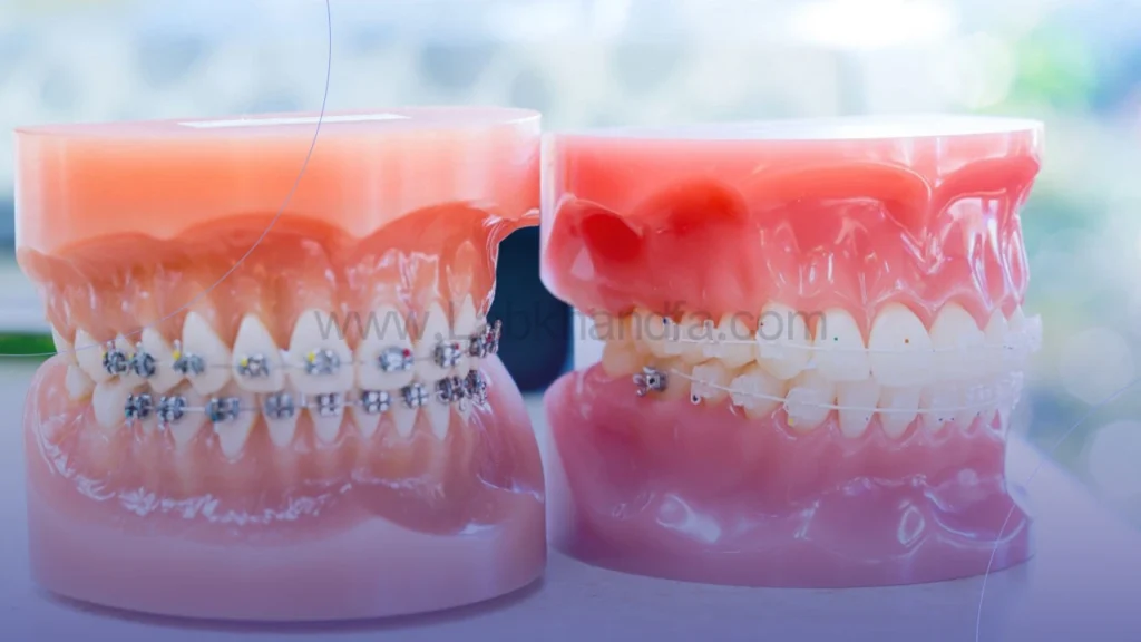 ارتودنسی ثابت