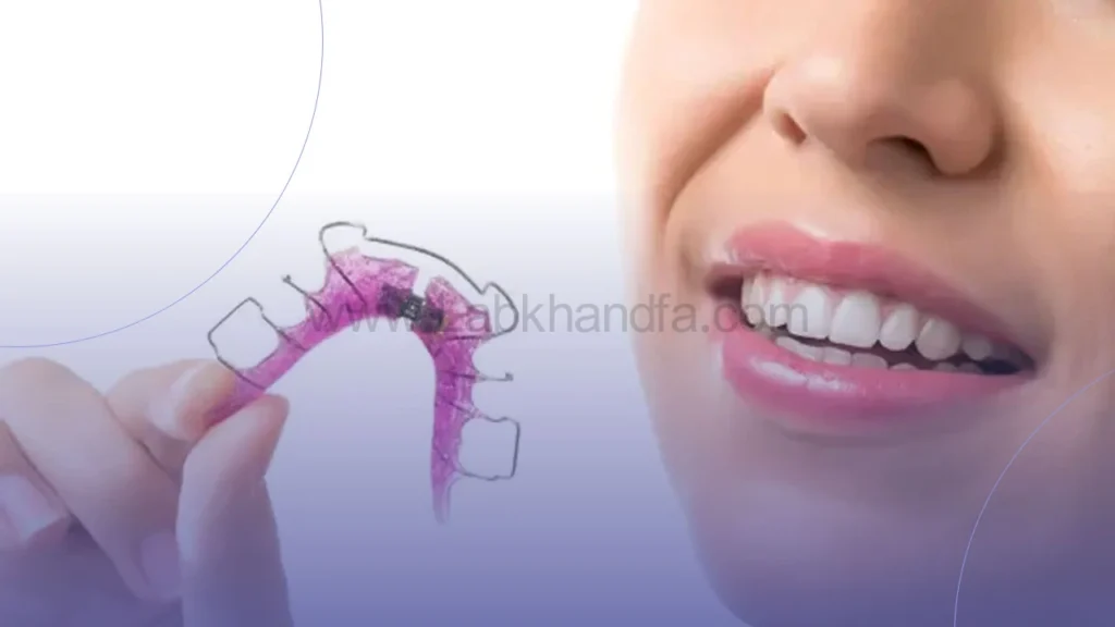 ارتودنسی متحرک