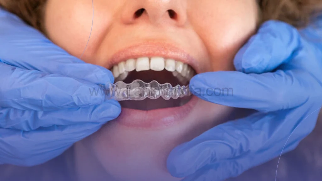 ارتودنسی نامرئی