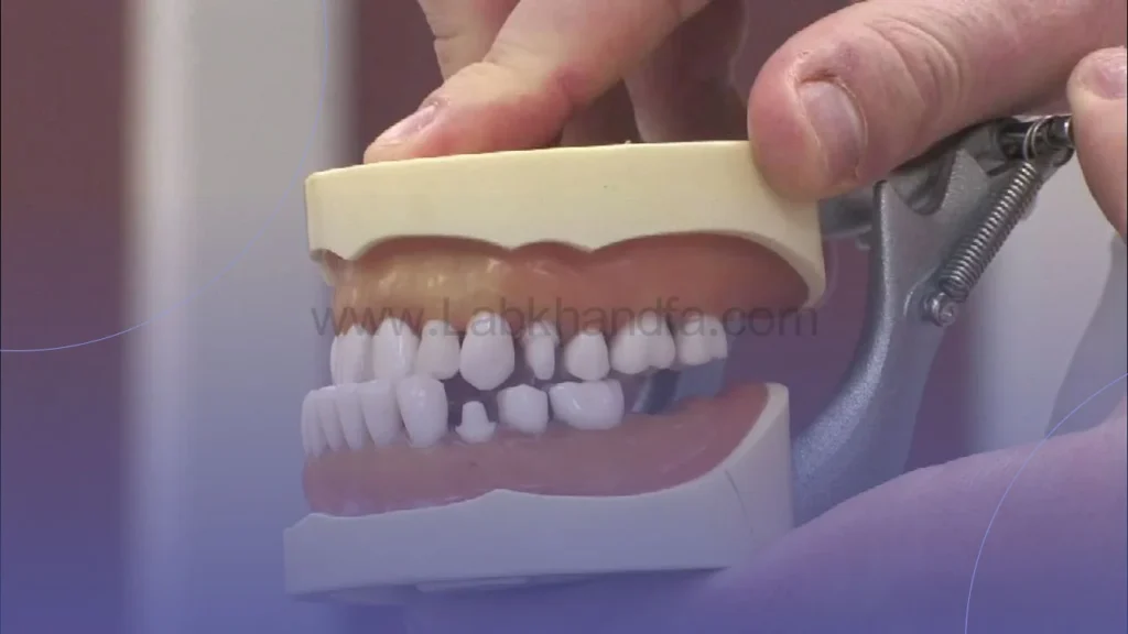 ناهنجاری های فکی