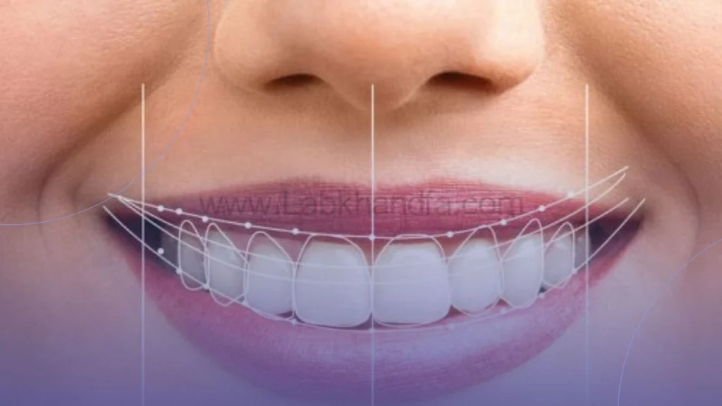 طراحی لبخند