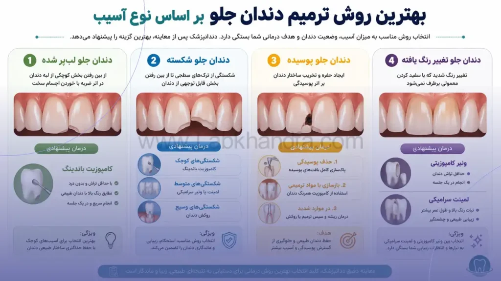 اینفوگرافی بهترین روش ترمیم دندان جلو با توجه به نوع آسیب